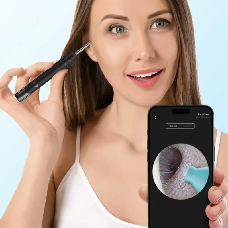 Smart Visual Ear Wax Removal Kit with HD Camera | Wireless Rechargeable Ear Cleaner with Soft Silicone Tips | Mobile App Compatible for Android & iOS